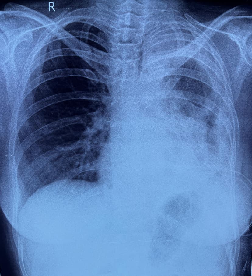 What is thoracic surgery