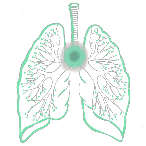 Chronic Bronchitis (COPD)